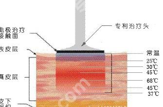 北京杜太超医生擅长的项目有哪些？小切口拉皮案例分享