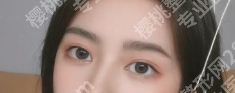 南京张荣明在哪个医院？真实的技术好吗？参考