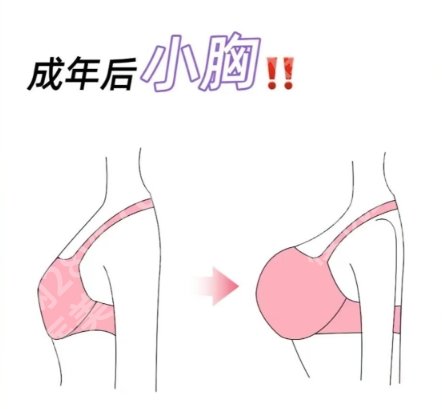 中日友好医院隆胸手术费用贵不贵？全新项目收费明细参考！