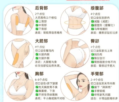 北京欧扬医疗美容医院口碑怎么样？做双眼皮技术好不好？案例展示！