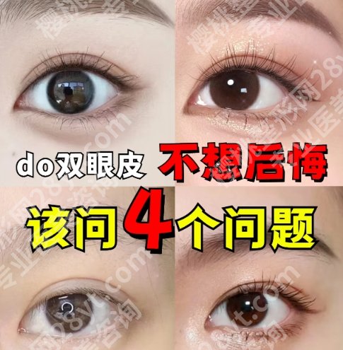 任军医生现在在哪家医院？医生资料+真人双眼皮案例展示！