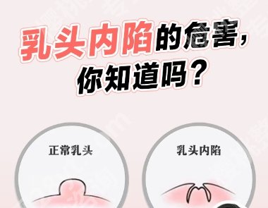 北京八大处乳头内陷手术怎么样？网友亲身经历分享！