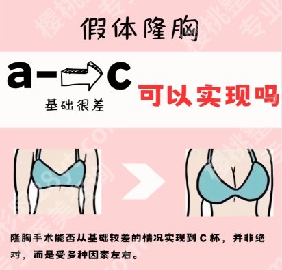 北京协和医院隆胸多少钱？医院口碑测评|价目表一览！