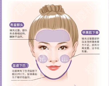 成都馒化修复的医生有哪些？朱慧东、白振华、潘红伟技术审美都很牛！
