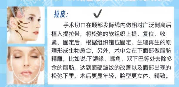 成都宋华敬拉皮手术案例曝光！术后小tips分享！
