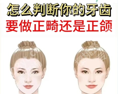 哈尔滨正颌手术好的医院有哪几家？top榜前五名单一览