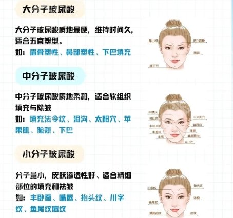杭州注射大佬医生名单更新！徐海飞、谢惠芬、李俊霞凭实力上榜！