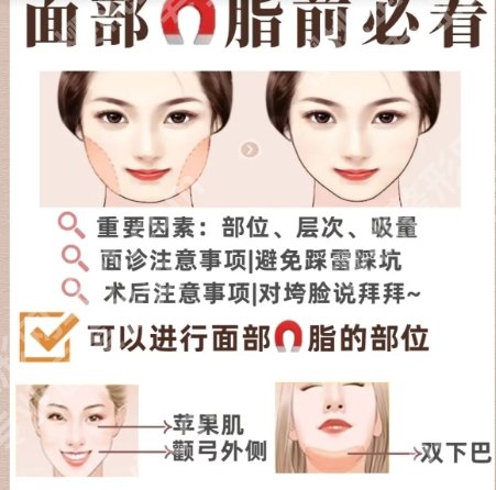 广医一院面部吸脂怎么样？医院口碑测评|顾客真实点评！