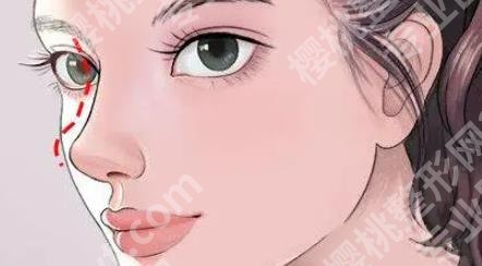 上海六院假体隆鼻价格贵不贵？附热心网友点评