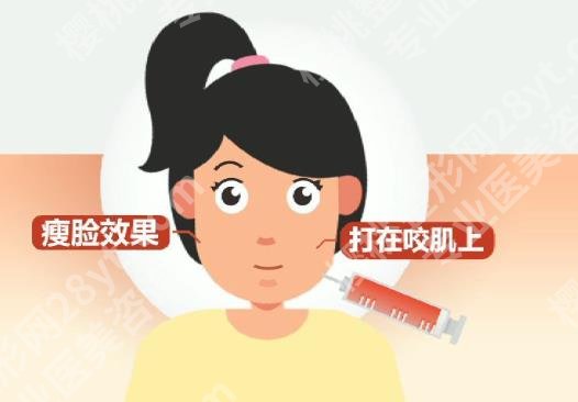 成都画美何珊珊医生怎么样？瘦脸真实过程记录！