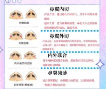 海淀医院假体隆鼻价格贵不贵？医院口碑评价、项目介绍！