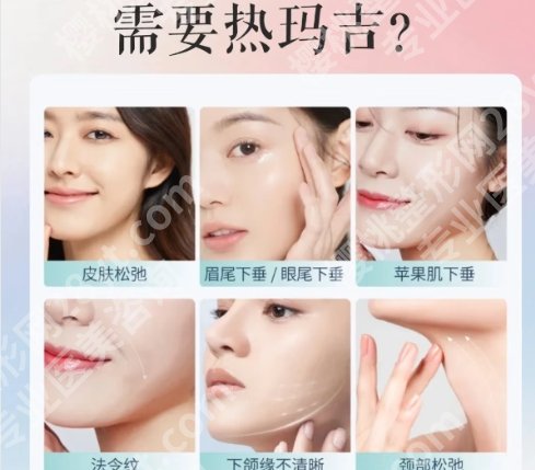 联合丽格的热玛吉是真的吗？效果如何？案例图反馈！