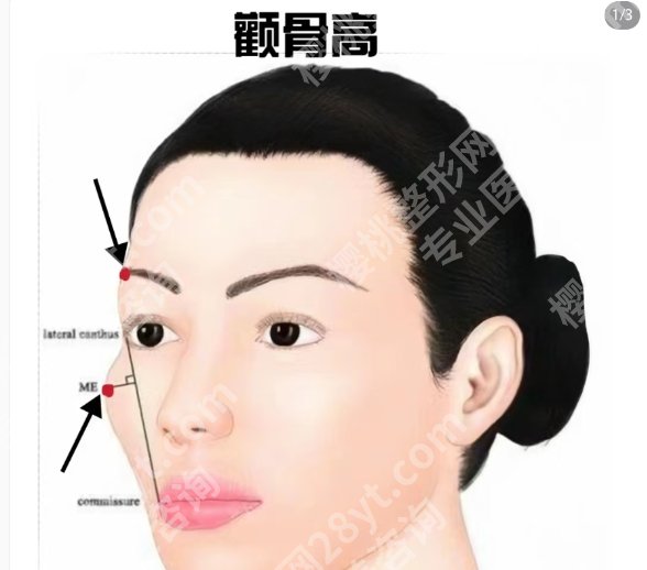 上海颧骨内推术哪家医院好?各医院真实的顾客点评来袭!