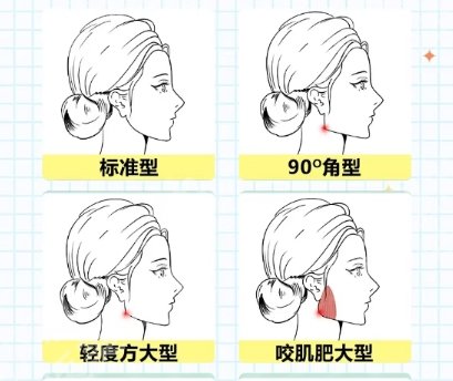 武汉下颌角磨骨费用贵不贵？2025收费标准更新！收藏再看