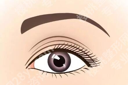 姜平医生做修复双眼皮怎么样？双眼皮技术分析，口碑查看