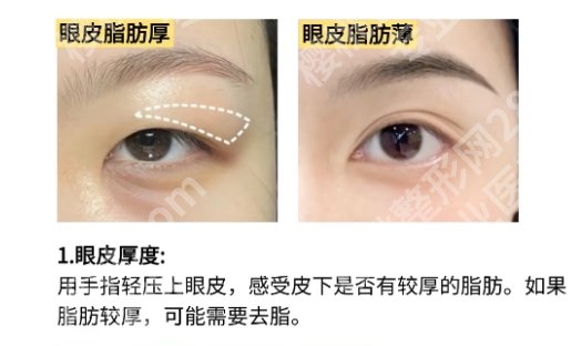 广州眼部整形医院基本信息详细介绍！附医生推荐！收藏再看！