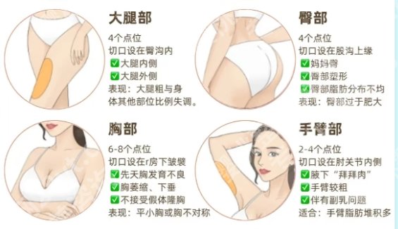 韦敏医生个人简历介绍！附项目面诊小技巧！医生口碑点评！