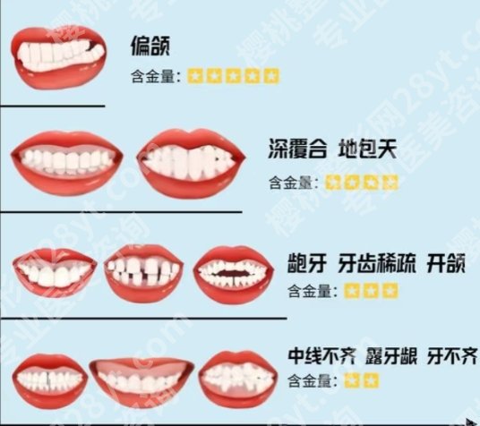 深圳北大医院正颌怎么样？经典案例附上！见证美丽蜕变