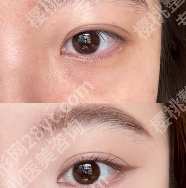 西京医院整形科做眼袋价格贵不贵？热心网友点评及面诊技巧get！