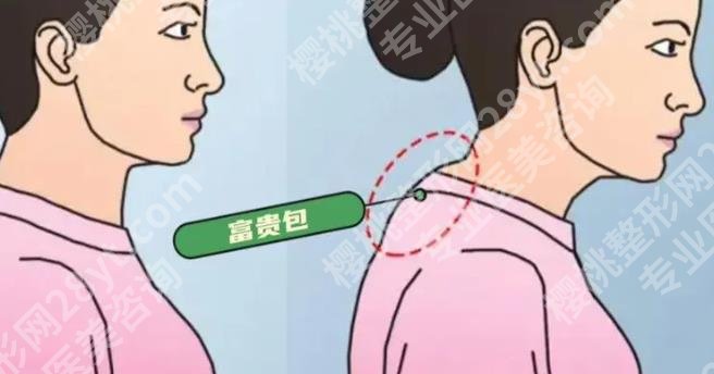 西京医院富贵包手术挂那个科？医院预约挂号攻略及案例曝光！