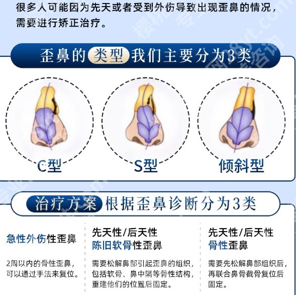 北京八大处歪鼻矫正手术费用多少钱？2万元起步，田孝臣、王克明等性价比高！