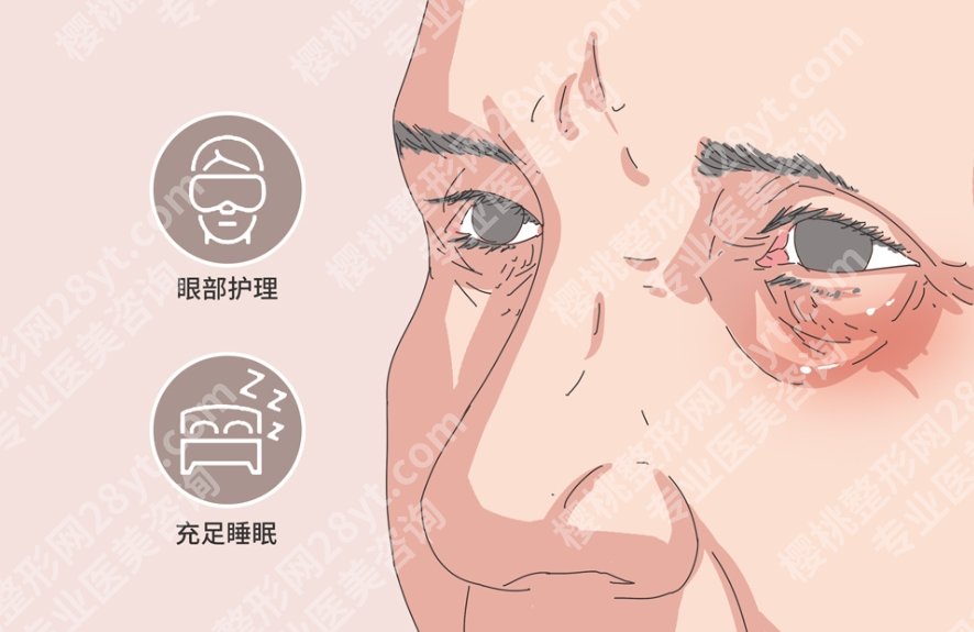 北医三院去眼袋手术价格贵不贵？去眼袋手术小问答附上！