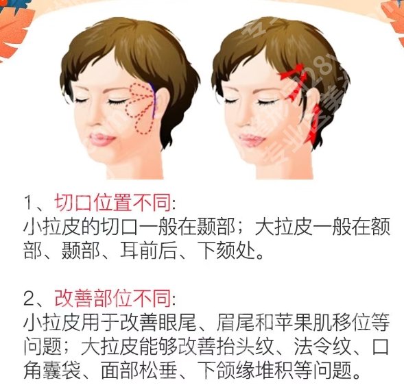 北京联合丽格拉皮手术做的怎样？医生团队实力雄厚！内附真人案例