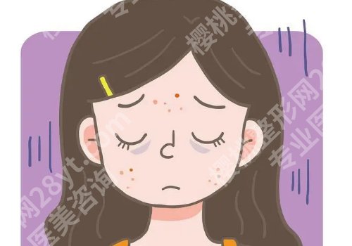 沙井人民医院激光去痘坑效果怎么样？预约挂号攻略来袭！