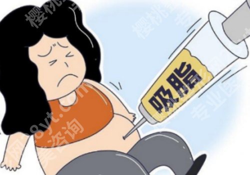 深圳黄海侠抽脂怎么样？基本信息、体验感反馈来袭！