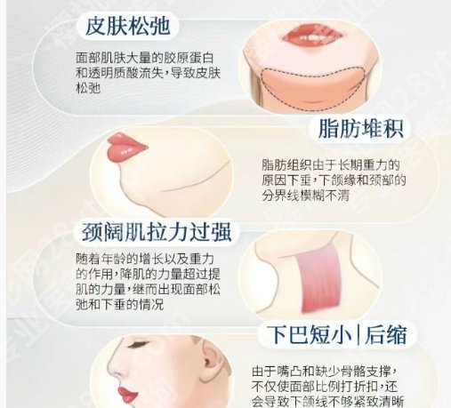 吴国平下颌角价格贵不贵？2025全新价目表更新！