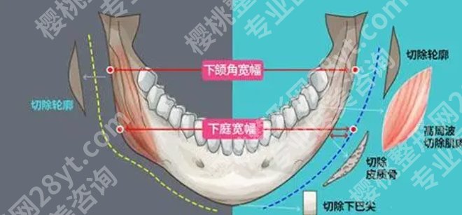 浙医二院假体下巴挂什么科？主打项目-价目收费分享！