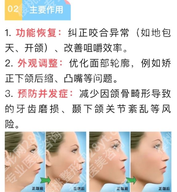 海淀医院正颌手术费用曝光!25年2.6万元起!专业医师团队介绍!