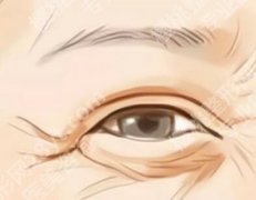 薇旖美打眼周细纹多久见效？常见问题和注意事项更新