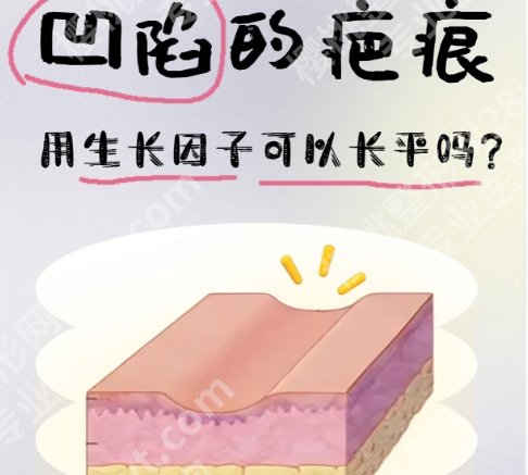 西安美莱王洪取生长因子技术如何？医生简介、网友反馈和价格更新！