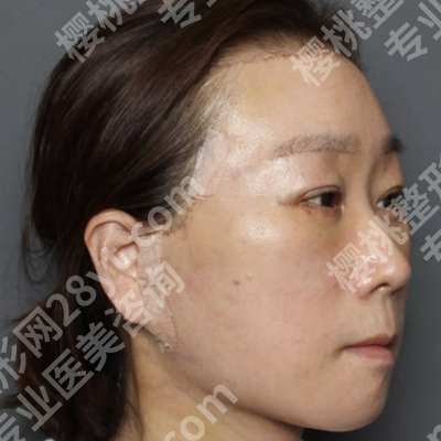 北京协和医院激光美容技术好吗？医生资料、面诊攻略更新！