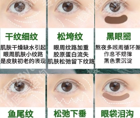 2025孙逸仙医院祛眼袋多少钱？6200元起！张金明‌、梁伟强技术口碑都好！