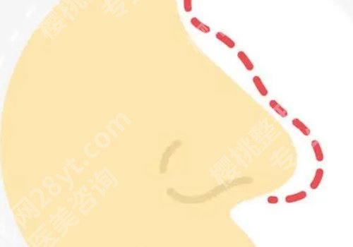 彭栋梁做鼻子怎么样？详细介绍、口碑点评、真实案例反馈！