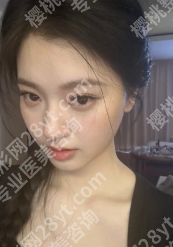 彭栋梁做鼻子怎么样？详细介绍、口碑点评、真实案例反馈！