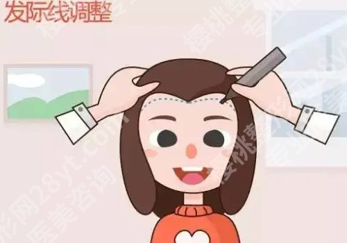 安徽医科大学第二附属医院植发好吗？技术水平高！顾客点评公布！