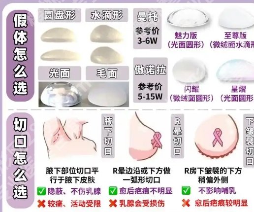 陈育哲隆胸怎么样？假体隆胸的案例超多、性价比很高！