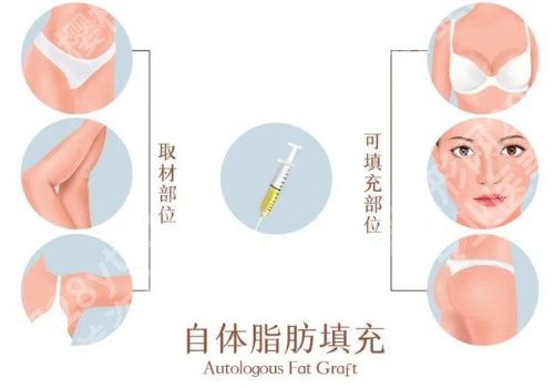 重庆华美脂肪填充哪个医生好？陶亮、陈凯、杨丽萍不容错过！