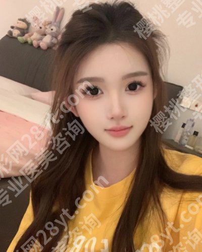 重庆华美脂肪填充哪个医生好？陶亮、陈凯、杨丽萍不容错过！