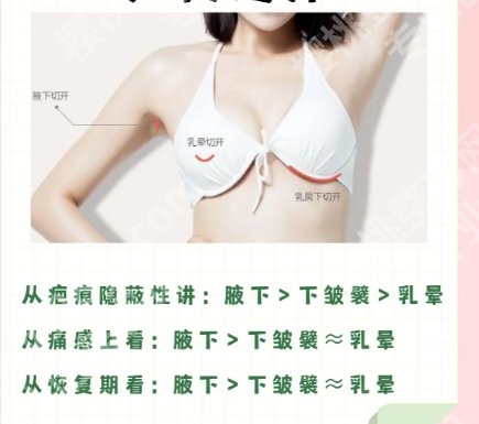 吴毅平医生假体隆胸技术如何？沉稳熟练、价格42193元起！