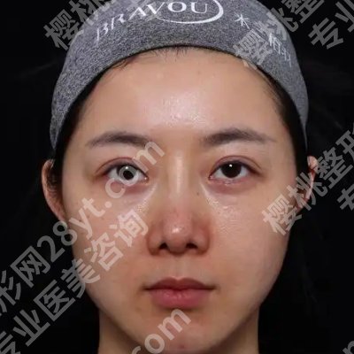 2025上海国际医学中心祛疤手术价格高吗？低至3000元起！附医院详情！