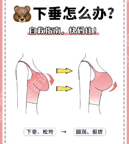 厦门胸下垂矫正医院排名曝光！2025精选优质医院分享！
