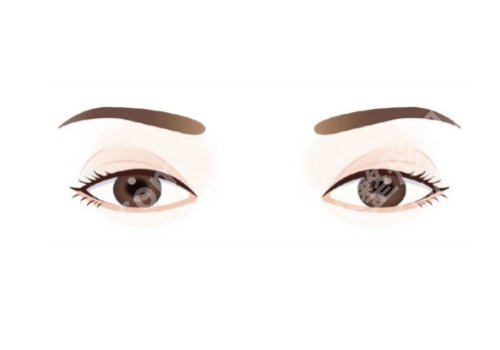 赵成利双眼皮怎么样?技术稳定、案例一览!