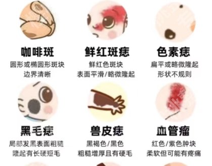 广州去胎记公立三甲医院排名，一键查看医院名单