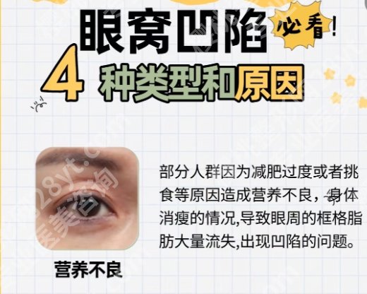 北京十大眼科医院排名榜公布一览！同仁、协和、北大人民医院等实力很牛