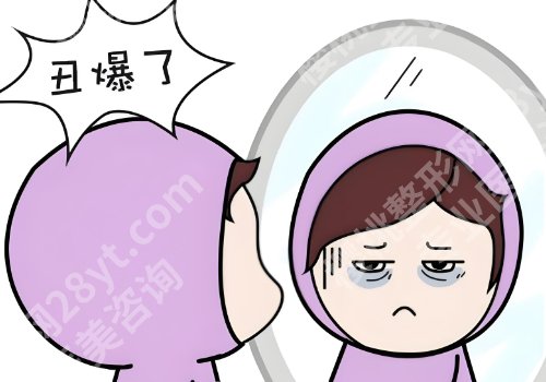 王科学微创去眼袋是真的好吗？技术大牛！案例多、反馈好