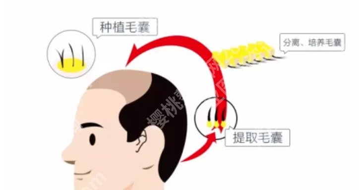 十大植发正规医院排行公布，都是值得信赖的